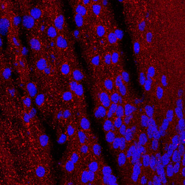 IF of a mouse lens labeled with DSHB antibody PCRP-JAZF1-1C1 against JAZF zinc finger 1 (red). Image credit: Lachke Lab, University of Delaware.
